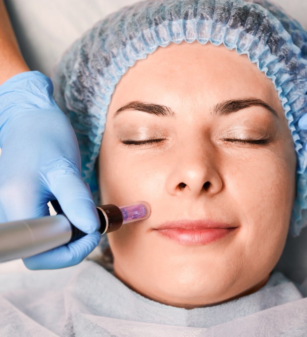 Close up of beautician hands in sterile gloves using dermapen during skincare procedure. Young woman receiving facial treatment in beauty salon. Concept of skincare and collagen induction therapy.