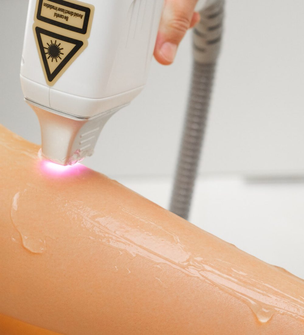 expert-does-laser-hair-removal-of-leg-with-smeared-2023-11-28-01-27-52-utc_Easy-Resize.com